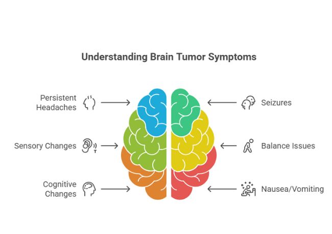 Symptoms of Brain Tumors